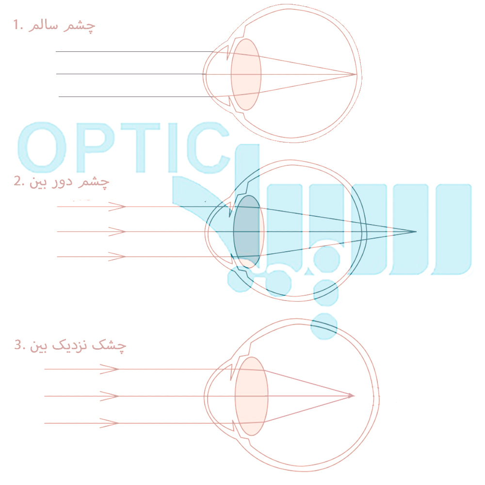 نمودار تشکیل تصویر در شبکیه